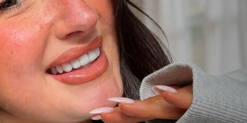 Teeth whitening at Seren Dental